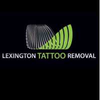 Lexington Tattoo Removal Logo