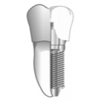 Main Line Periodontics & Dental Implants, PC Logo
