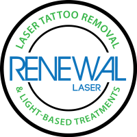 Renewal Laser Tattoo Removal Logo