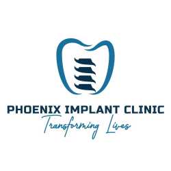 Phoenix Implant Clinic