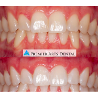 Premier Arts Dental Logo