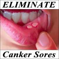 Canker Sores & Mouth Ulcers Logo