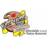 East Coast Laser Tattoo Removal Logo
