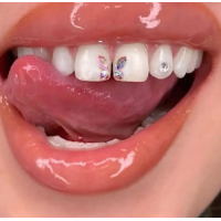 Sparkle Now Teeth Whitening Logo