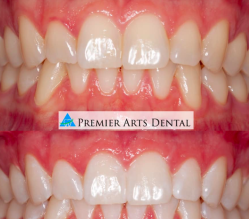 Premier Arts Dental